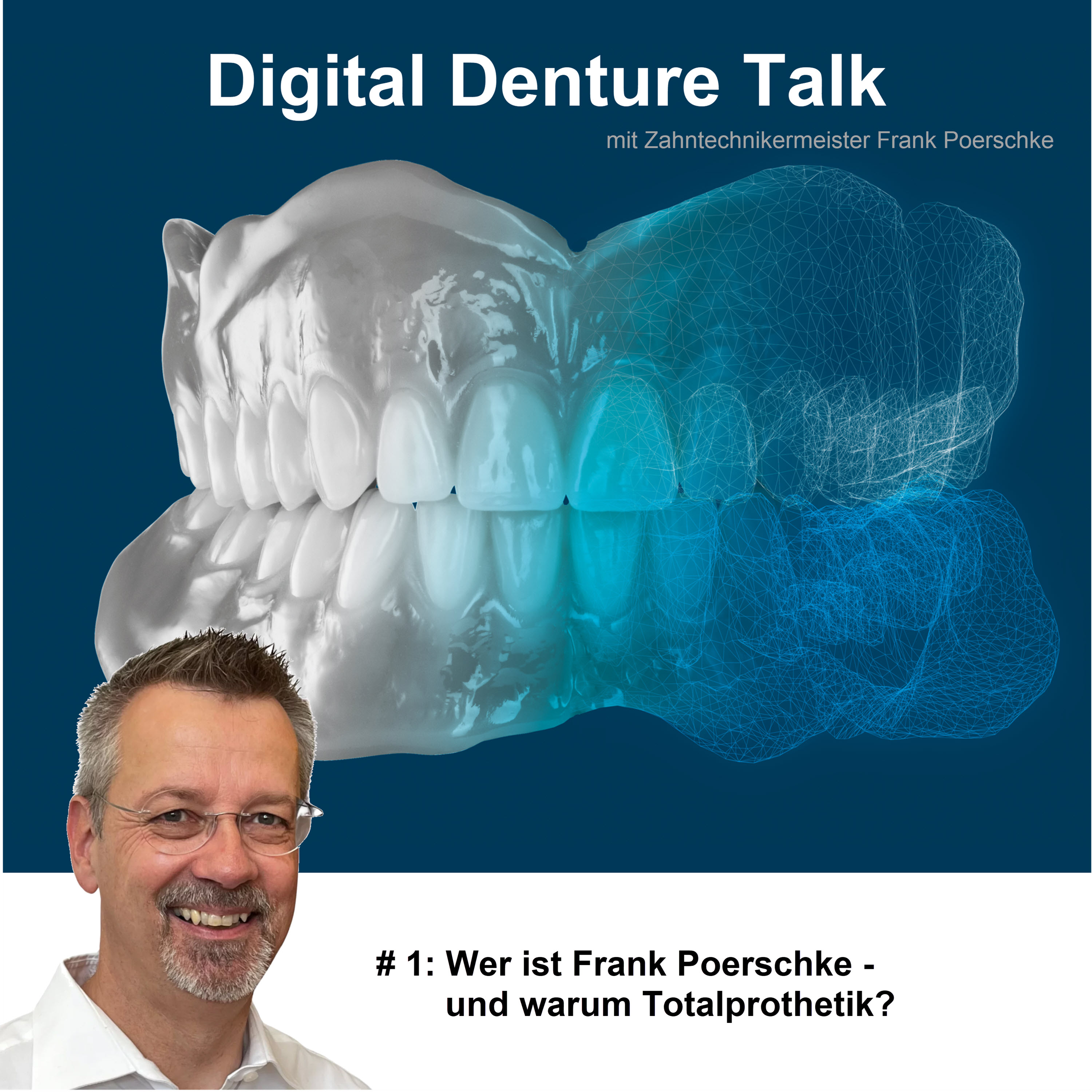 Digital Denture Talk